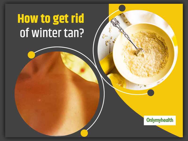 Winter Tan On Skin? Shoo It Away With These 8 Simple Natural Remedies