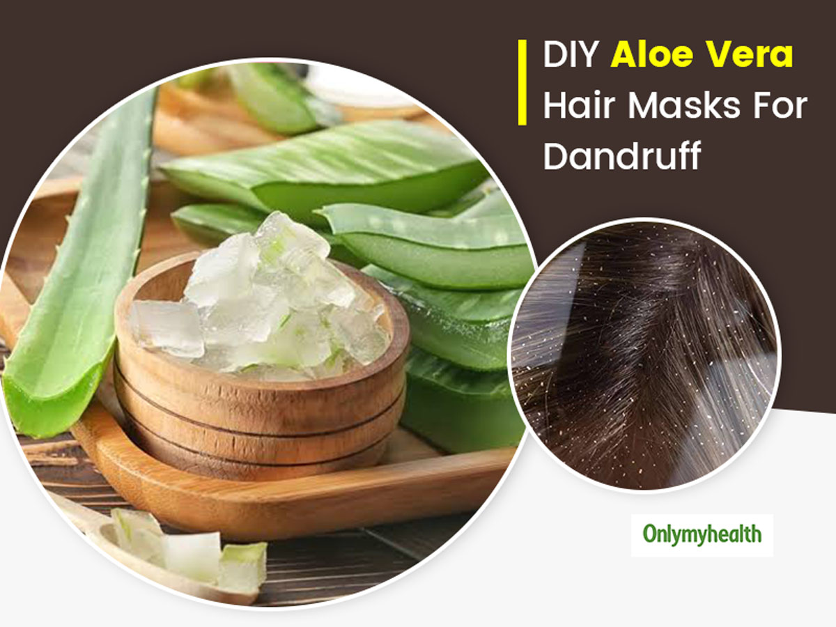 Try These 6 Aloe Vera DIY Hair Masks To Treat Dandruff