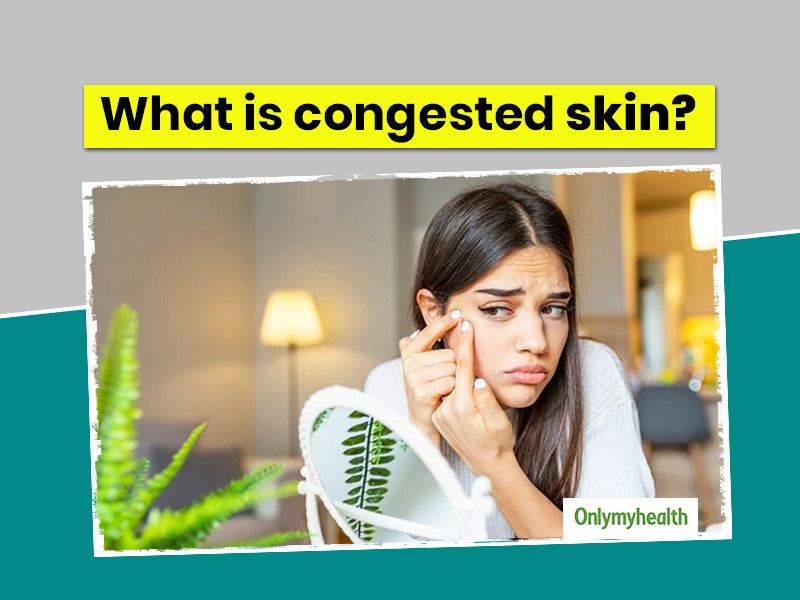 What Is Congested Skin? Here's How You Can Prevent And Treat It