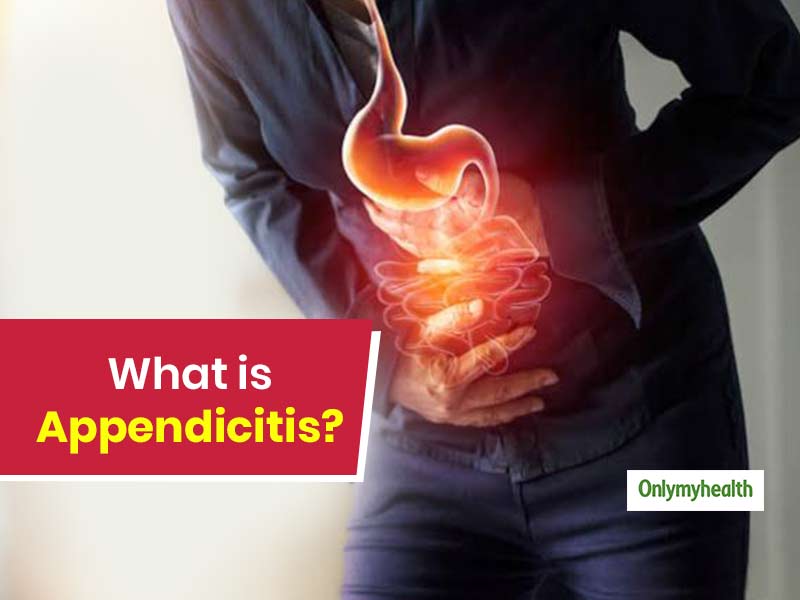 What Is Appendicitis? Here Are Its Signs, Causes And Treatment 