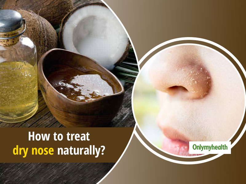 Dry Nose Due To Cold? Here Are 8 Useful Ways To Treat It Naturally