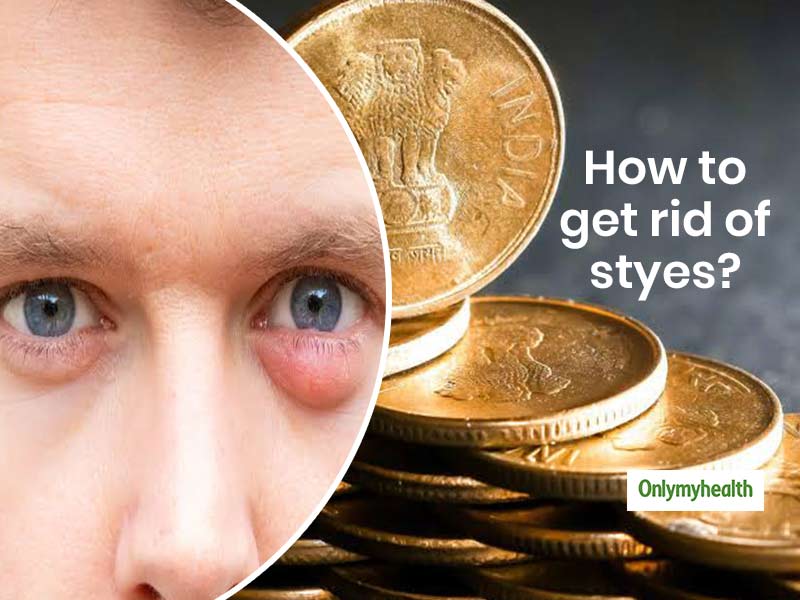 How to get rid of a stye overnight