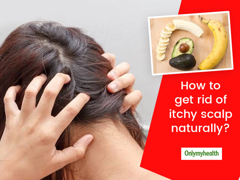 Itchy scalp deals remedy