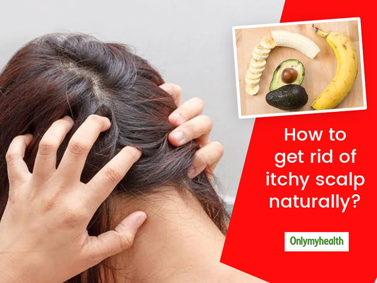 How To Get Rid Of Itchy Scalp Naturally? Try These 7 Home Remedies To Treat  And Tips To Prevent It