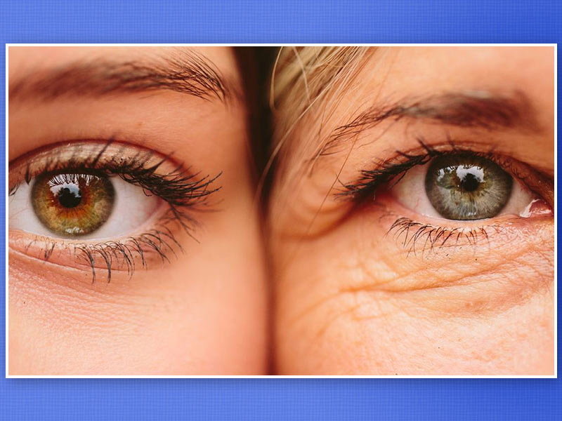 Why Do You Get Under-Eye Lines And Wrinkles? 