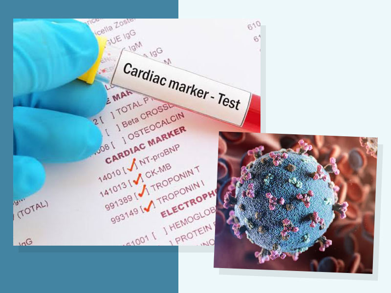 Key Biomarkers In New Age COVID-19 Testing That You Should Know About
