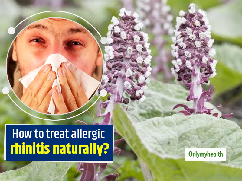 Try These 8 Useful Home Remedies To Treat Allergic Rhinitis Naturally