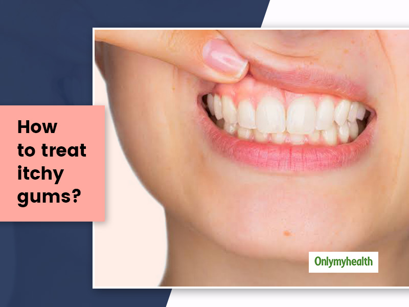 Itchy gums: Causes, Treatment And Prevention From An Expert