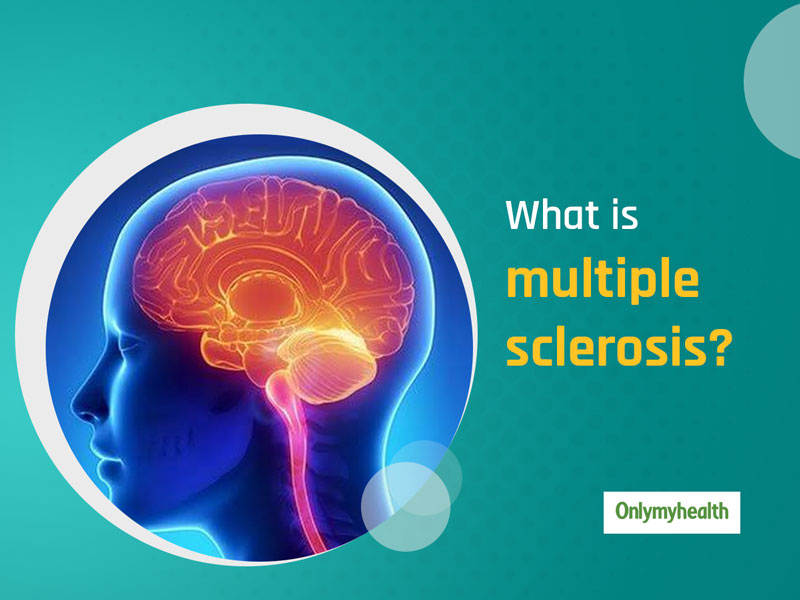  Multiple Sclerosis Awareness Month: Know The Types, Symptoms, Causes And Treatment Of This Chronic Disease