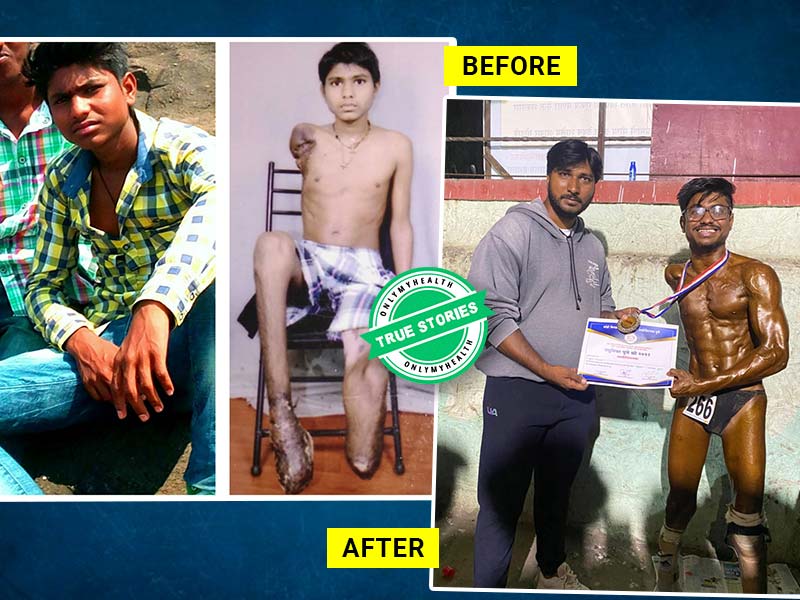 True Story: Here's How Suraj Gaywal Went On To Win Titles In Bodybuilding Competitions With Prosthetic Legs 