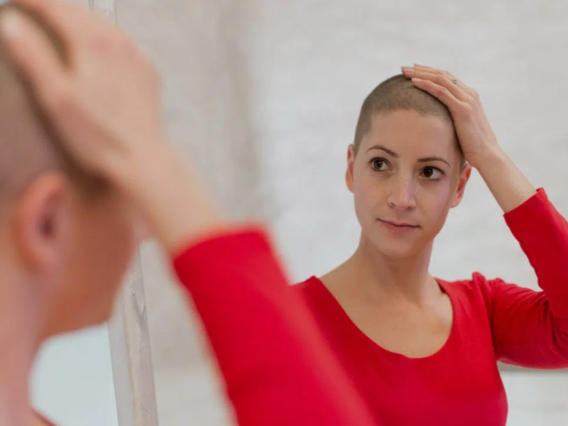 Spironolactone Safely Treats Hair Loss in Female Breast Cancer Survivors  Without Increasing  Docwire News