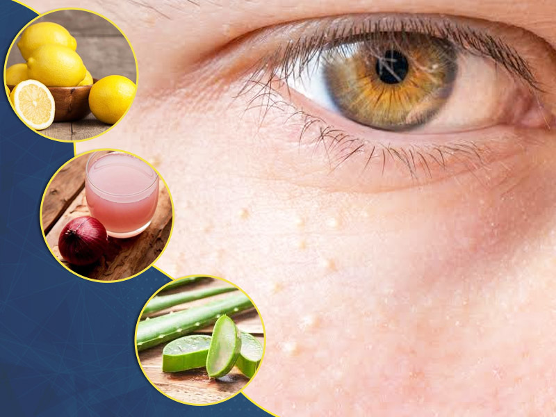 Red Bumps Under The Eyes: Causes and Effective Treatments