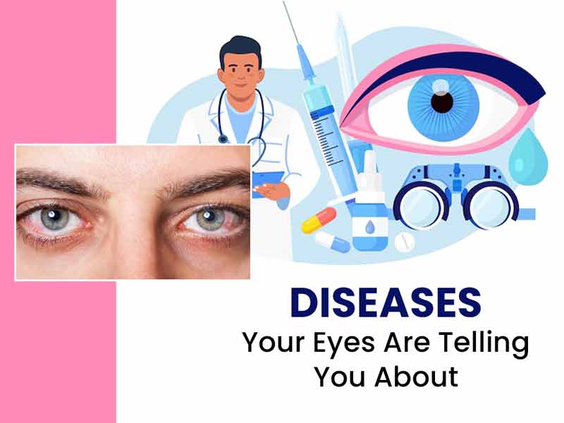 Warning signs in your eyes that could signal serious health issues  including stroke - Mirror Online