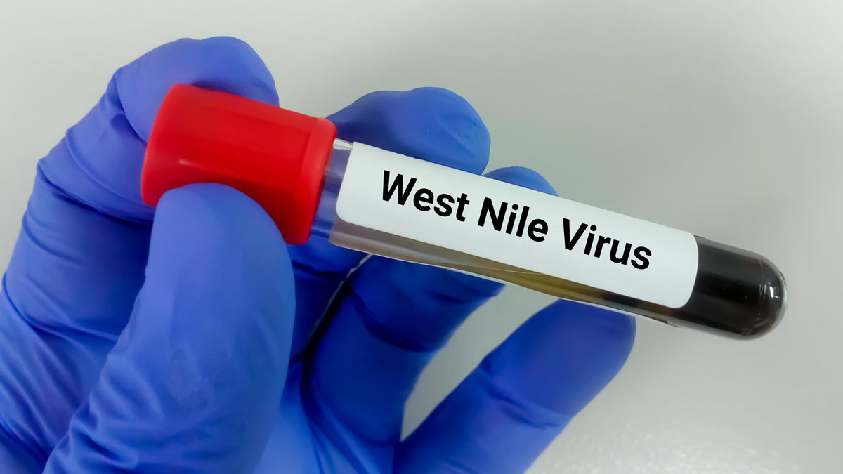 West Nile Virus: Symptoms And When Should We Worry?