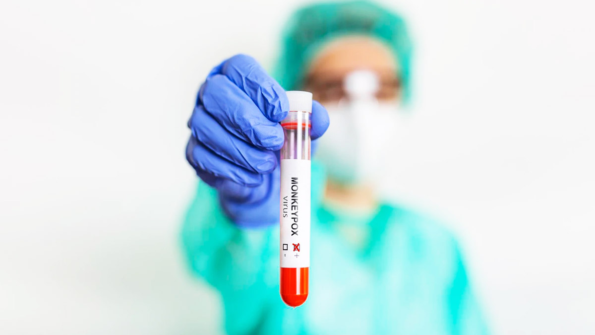 ICMR Invites Bids To Develop Vaccine For Monkeypox 