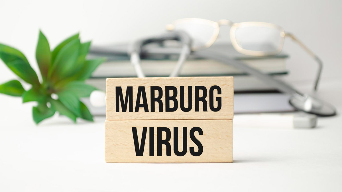 Marburg Virus: How Worried Should You Be Of The Potentially Fatal Virus