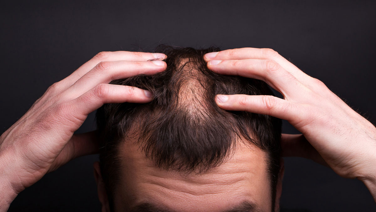 Hair And Libido Loss Added To The List Of New Long Covid Symptoms