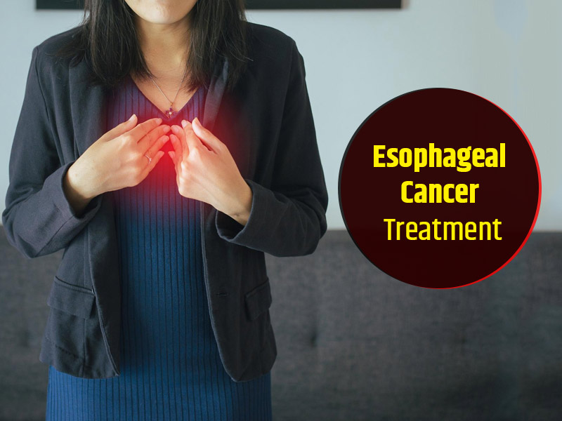 What is Esophageal Cancer And How To Treat It, Doctor Elucidates