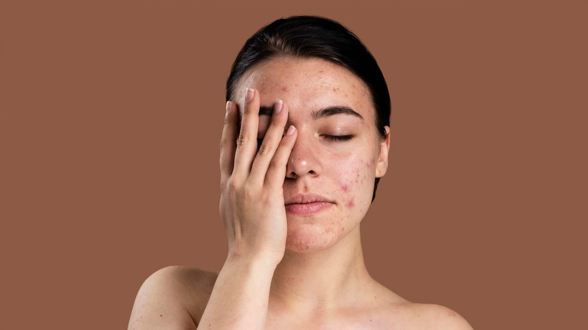 Skincare Tips for Tired and Damaged Skin
