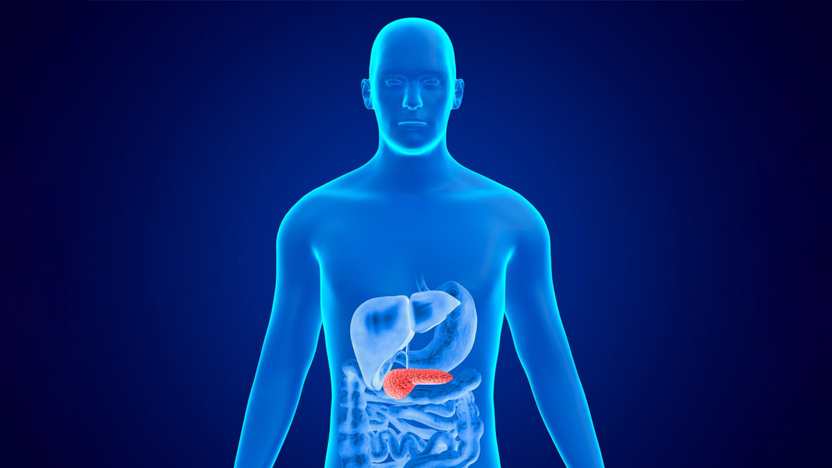 Study Finds Pancreatic Cancer Linked To Obesity May Be Fueled By Stress Granules