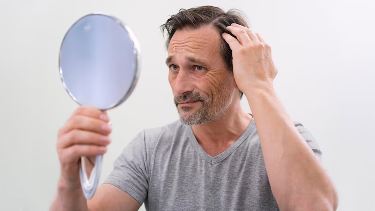 4 Types Of Psychological Damage Of Hair Loss In Men