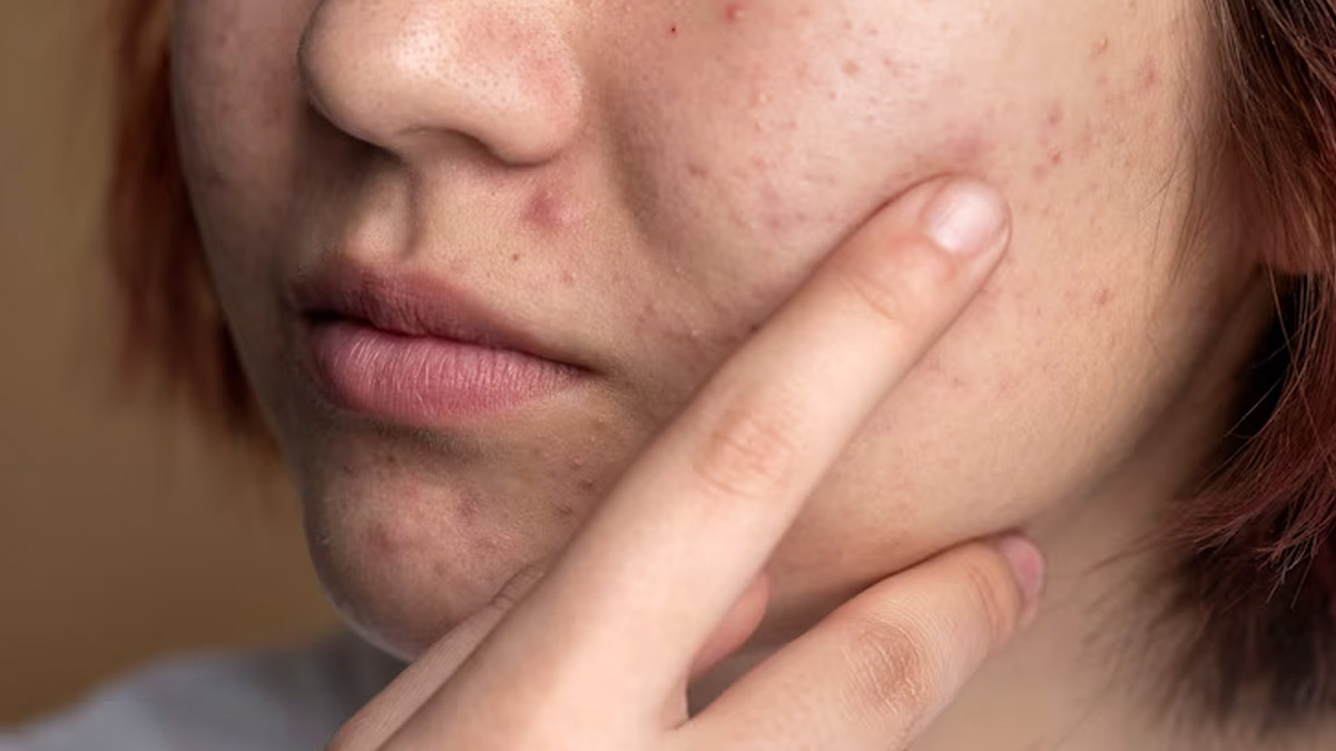 7 Natural Ways To Deal With Large Skin Pores