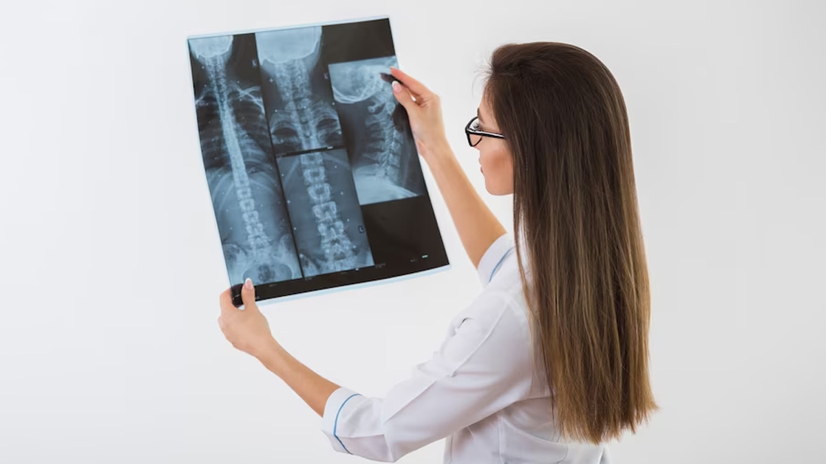 Digital X-Ray: Empowering Medical Imaging and Healthcare Diagnostics