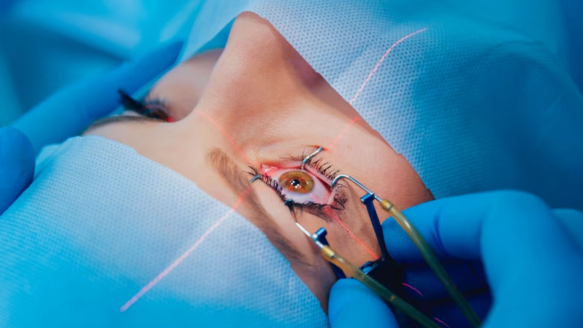 Laser Vision Correction: Before You Laser Your Vision, Read These 10 Crucial Facts