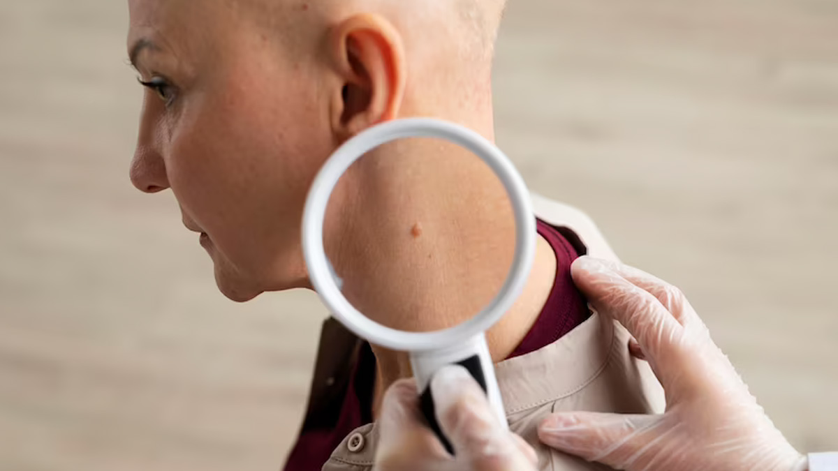 Spotlight on Skin Cancer: Expert Shares 5 Sun Safety Tips for Every Season