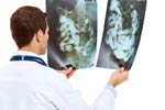 How Barium Enema is performed?