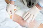 अमेरिका और यूरोप की तर्ज पर भारतीय मरीजों के लिये बने 'कृत्रिम घुटने'