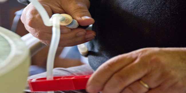 पुरुषों में क्रॉनिक किडनी की बीमारी के लक्षण