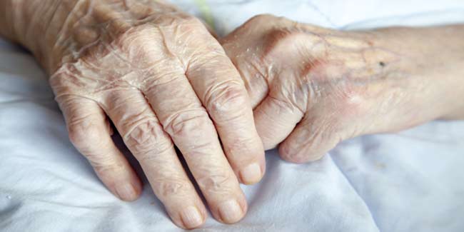 These Symptoms of Rheumatoid Arthritis will Tell you if you Have it or Not