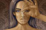 How is Scalded Skin Syndrome Treated?