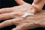 Prevention of Spider Veins