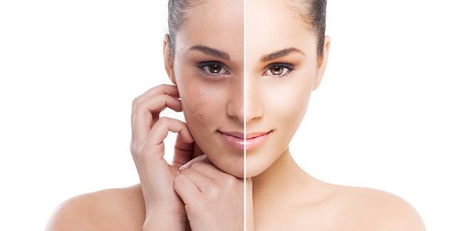 Disadvantages Of Skin Bleaching Skin Care