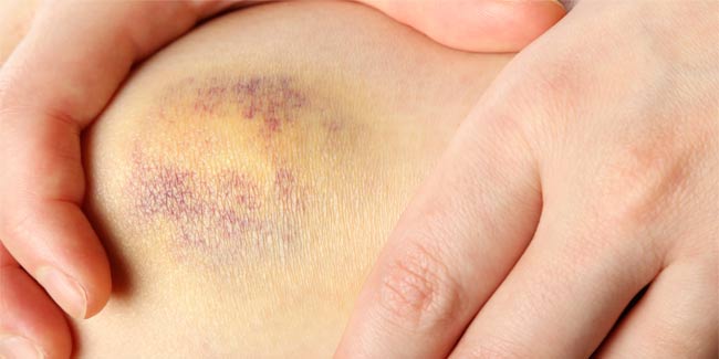 How to Care for Skin Abrasions