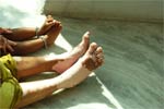 Precautions to take against Vitiligo