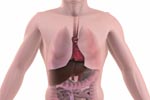 What is Gastrointestinal Amebiasis?