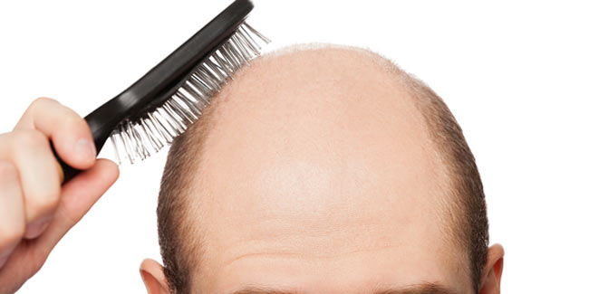 Vampire Therapy may Cure Baldness
