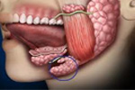 What are Salivary Gland Disorders?