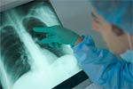 What are X-Rays?