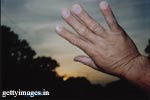 सुबह के समय हाथों में सूजन आने के हो सकते हैं कई कारण
