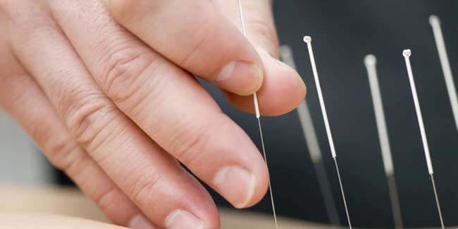 The Risks and Side-effects of Acupuncture