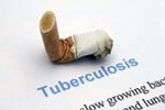 Development on Tuberculosis in Vain, says WHO