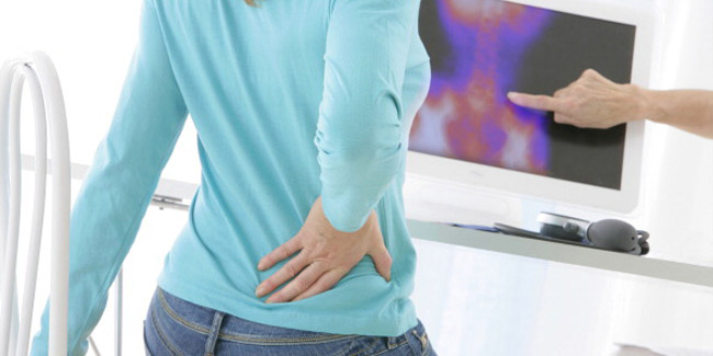 What are the symptoms of Klippel Feil Syndrome?