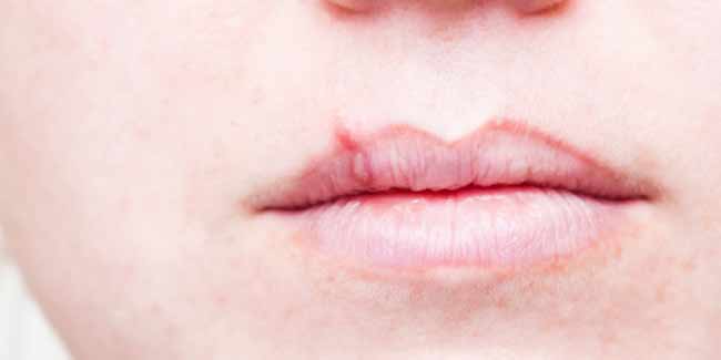 What does current research on Epidermolysis Bullosa focus on?