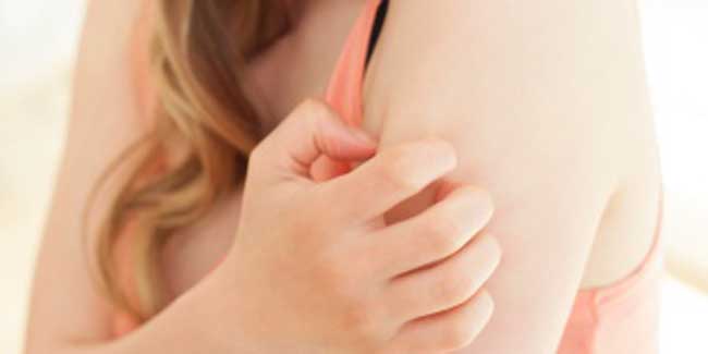 What is Lichen Sclerosus?