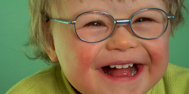 What is Smith Magenis Syndrome?