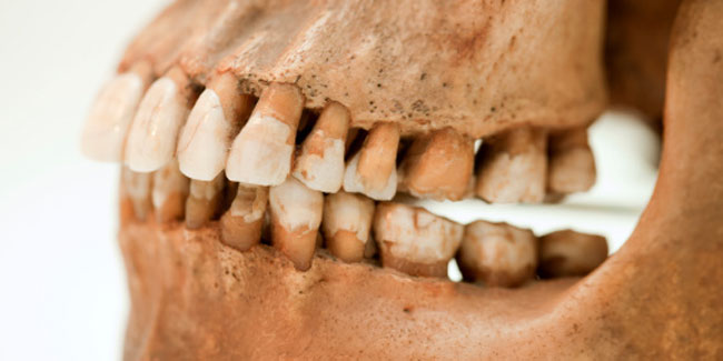 How can one prevent Dislocation of the TMJ?